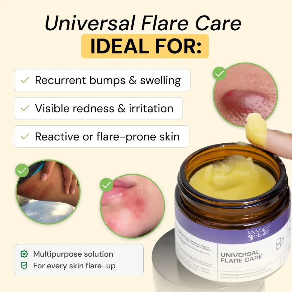 MyMagicHealer Universal Flare Care – Multi-Purpose Solution | Skin Flare-Ups - Hidradenitis Suppurativa, Folliculitis, Boils, Cysts | Anti-Chafing | Irritated Skin Relief w/Propolis & Egg Yolk 1 oz MyMagicHealerBuy Supplements Australia