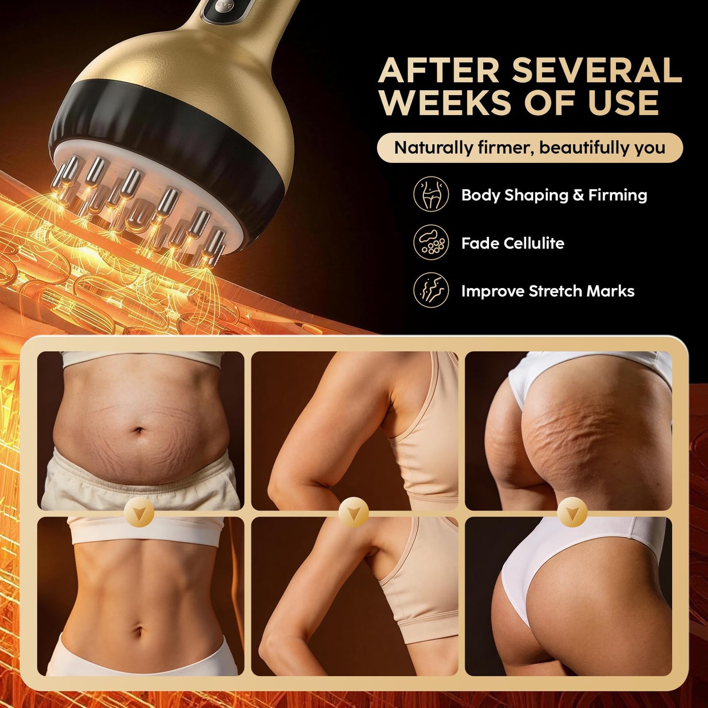 OVGIAP Lymphatic Drainage Massager & Anti-Cellulite Massage Tool, Body Sculpting Device for Legs, Arms & Stomach, Supports Smoother Skin, with Gentle Warming & Vibration - Gold OVGIAP buy supplements Au