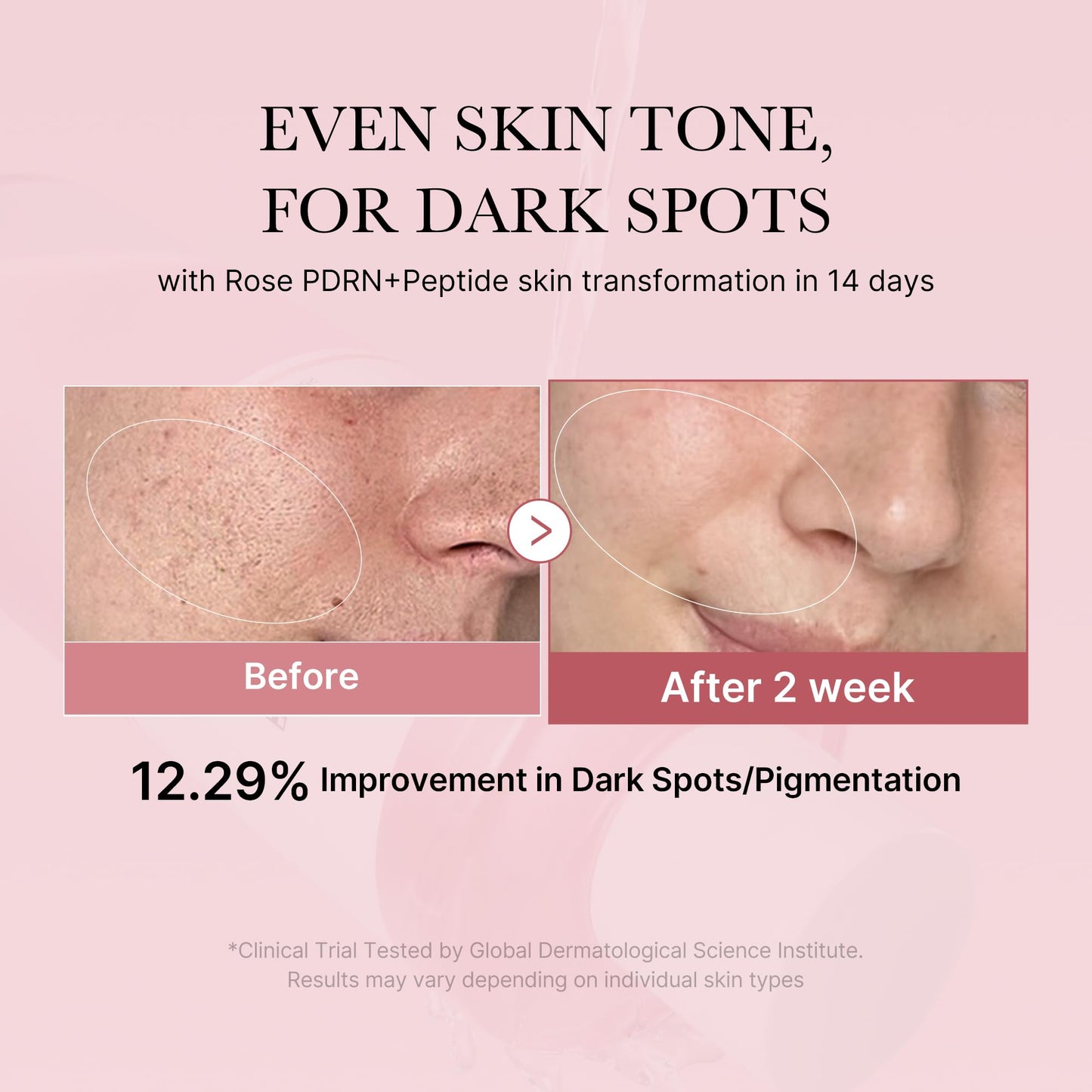 medicube PDRN Toner Rose PDRN Peptide Toner | Lightweight & Watery Type for Skin Boosting, Soothing and Calming, Uneven Skin Tone | with Rose, Peptide, Niacinamide | Korean Skincare, 8.45 fl.oz medicubeBuy Supplements Australia