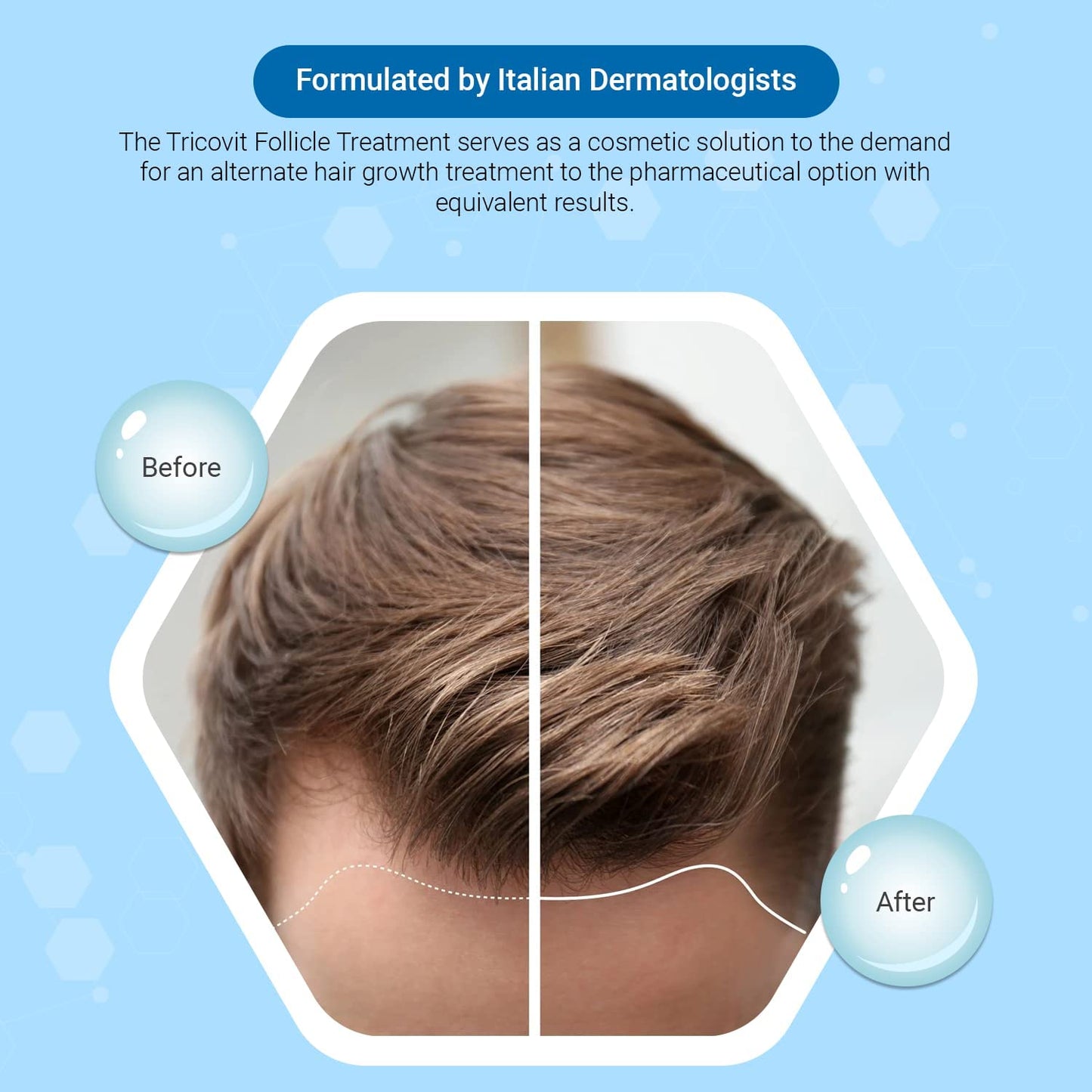 Tricovit Hair Growth Supplement - Nail & Hair Health Vitamins with Amino Acids, Minerals & Antioxidants - Dermatologist-Formulated & Gluten-Free Vitamins and Supplements for Women & Men (60 tablets) TricovitBuy Supplements Australia