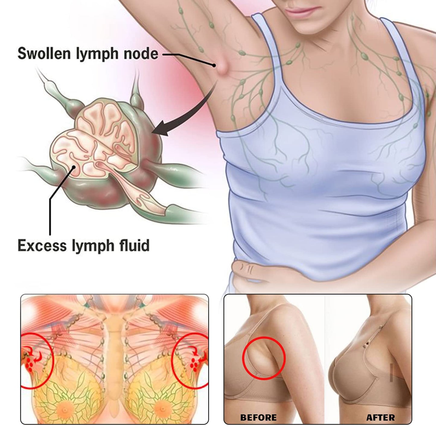 BXQJRJ 24Pcs/Box Herbal Lymph Nodes Patch,Lymphatic Drainage Patch/Patches,Herbal Lymphatic Drainage Care Patch,Neck Lymph Nodes Patch, Lymphatic Massage for Men and Women BXQJRJ buy supplements Au