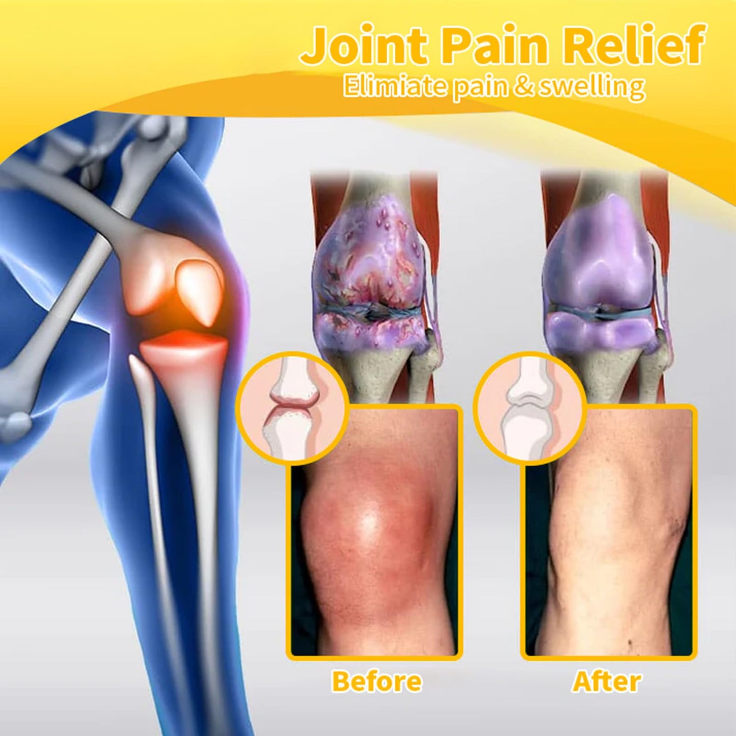 Luhaka Botulinum Toxin & Bee Venom Pain-Relief Bone Healing Cream,Bee Venom Cream,Effectively improve joint mobility (1PC) LuhakaBuy Supplements Australia