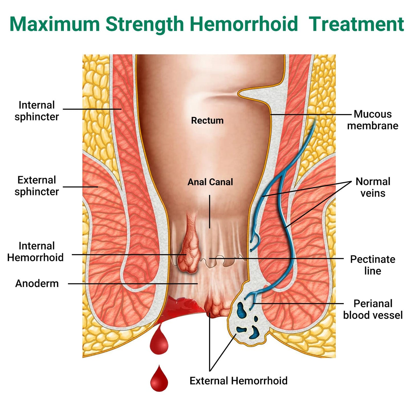 Hemorrhoid Treatment Ointment, Maximum Strength Treatment & Fast Relief for Pain, Itching, Burning, Swelling, Fissure, Bleeding, Discomfort, Long-Lasting Internal & External Hemorrhoid Cream, (2-Pack) LMNOOPBuy Supplements Australia