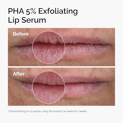 The Ordinary PHA 5% Exfoliating Lip Serum, Hydrating Overnight Lip Exfoliator Treatment, 0.5 Fl Oz