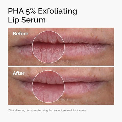 The Ordinary PHA 5% Exfoliating Lip Serum, Hydrating Overnight Lip Exfoliator Treatment, 0.5 Fl Oz
