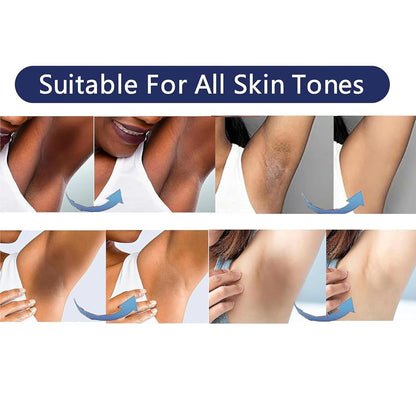 Vcetree Skin Bleaching Cream Skin Lightening for Body Intimate Areas, Private Parts, Underarm, Knees, Elbows, Inner Thigh, Bikini Area