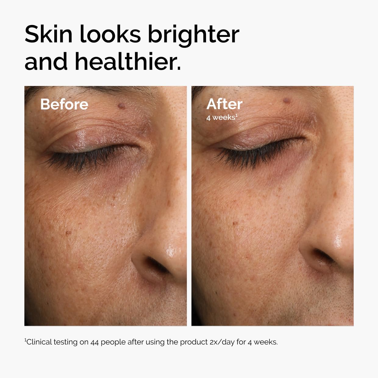 The Ordinary Multi-Antioxidant Radiance Serum, Vitamin C Serum For Face, Brighten & Protect Skin – Boosts Glow
