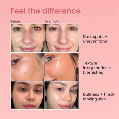 QUIA Collagen Wrapping Mask 75ml - Clinical +92% Firmer Appearance - Overnight Glass Skin Peel Off - Korean Skincare
