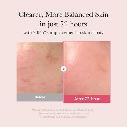 medicube TXA+Niacinamide 15% Glow Facial Serum for After Spot Care | All-in-One Daily Korean Skincare | Uneven Skin Tone, Texture, and Hydration Care | High-Potency Tranexamic Acid 5% | 1.01 fl.oz medicubeBuy Supplements Australia