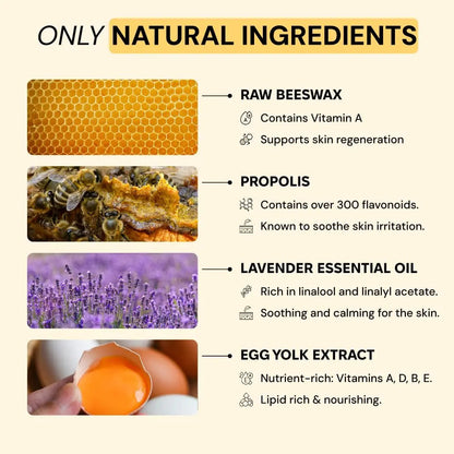 MyMagicHealer Universal Flare Care – Multi-Purpose Solution | Skin Flare-Ups - Hidradenitis Suppurativa, Folliculitis, Boils, Cysts | Anti-Chafing | Irritated Skin Relief w/Propolis & Egg Yolk 1 oz MyMagicHealerBuy Supplements Australia