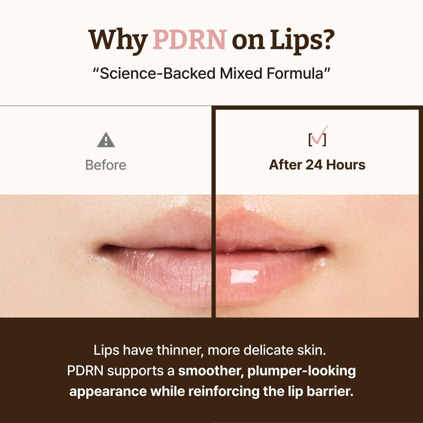 Dr. Reju-All Advanced PDRN Rejuvenating Lip Serum – Hydrating Lip Balm with Lipozip PDRN for Glowy, Dewy Lips – Gentle Exfoliating & Smoothing Lip Moisturizer – Hibiscus & Lactic Acid – 0.3 Fl Oz Dr.Reju-AllBuy Supplements Australia