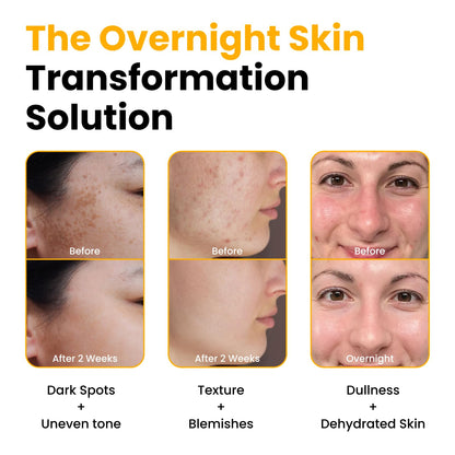 QUIA Turmeric + Kojic Acid Overnight Wrapping Mask – Hydration Mask for Glowing Skin
