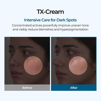DR.Melaxin TX Tranexamic Acid CREAM | Skin freckle Cream, Blemishes, Anti-pigmetation korean skin care