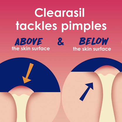 Clearasil Rapid Rescue Deep Treatment Acne Face Pads, Maximum Strenght with 2% Salicylic Acid Acne