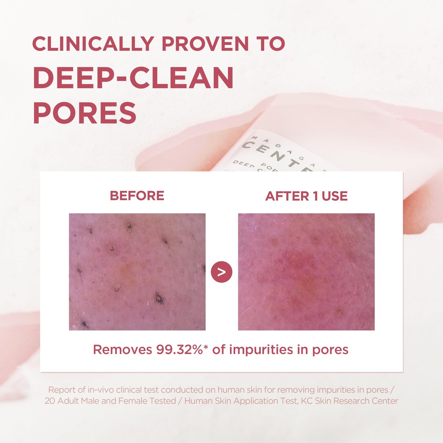 SKIN1004 Poremizing Deep Cleansing Foam, 4.23 fl.oz, 125ml, Makeup Remover, Korean Face Cleanser with Himalayan Pink Salt