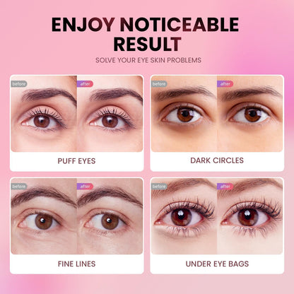 AILEORY Under Eye Patches (24 Pairs) - Tri-color Glitter Eye Gel Pads for Dark Circles, Puffy Eyes, Under eye Bags, Wrinkles