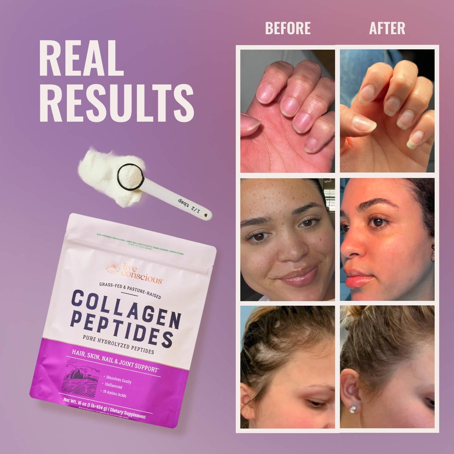 Live Conscious Collagen Peptides Powder - Naturally-Sourced Hydrolyzed Collagen Powder - Hair, Skin, Nail, and Joint Support - Type I & III Grass-Fed Collagen