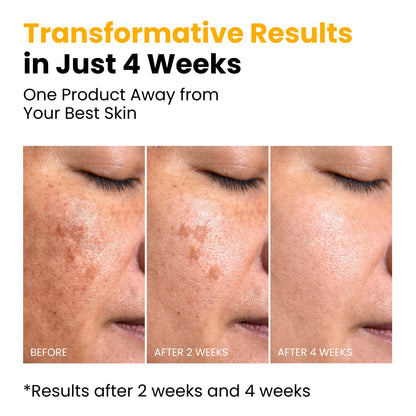 QUIA Turmeric + Kojic Acid Overnight Wrapping Mask – Hydration Mask for Glowing Skin