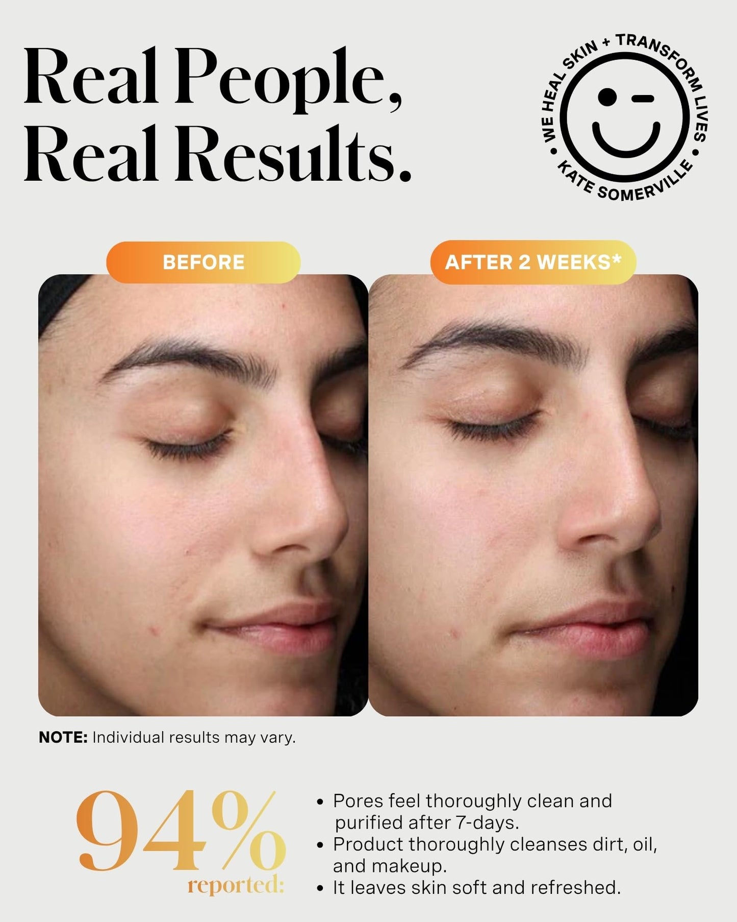 Kate Somerville ExfoliKate Cleanser – Daily Exfoliating Foaming Face Wash, Clinically Formulated Glycolic Acid and Lactic Acid Gentle