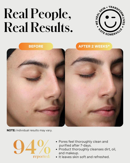 Kate Somerville ExfoliKate Cleanser – Daily Exfoliating Foaming Face Wash, Clinically Formulated Glycolic Acid and Lactic Acid Gentle