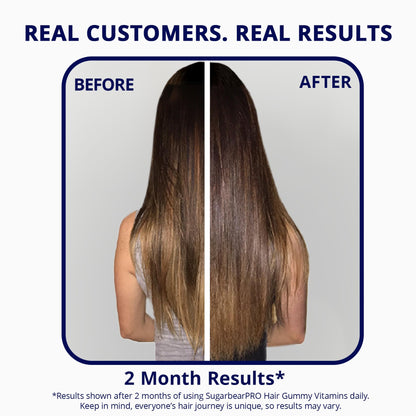 Sugarbear Hair Vitamin Gummy 2 Month Supply Extra Strength Biotin 6000mcg, Growth for Men & Women, Vegan Vitamin B12, MSM, Inositol, Omega 3, Elderberry, Certified Kosher, Halal, Cruelty-Free