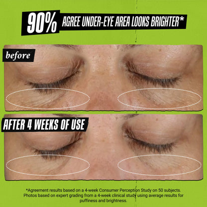 Kiehl's Avocado Eye Treatment, Nourishing and Hydrating Eye Cream, Avocado Oil and Caffeine to Energize and Invigorate Skin, Tired Eyes