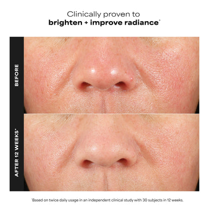 Paula's Choice BOOST C15 Super Booster, 15% Vitamin C Serum for Face, Face Serum with Vitamin E & Ferulic Acid