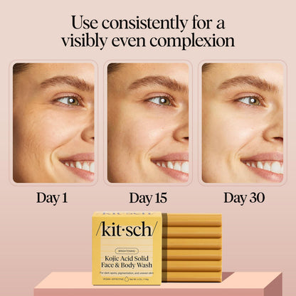 Kitsch Kojic Acid Soap – Turmeric Soap Bar with Hyaluronic Acid & Shea Butter – Brightening & Hydrating Body Wash & Face Wash for Dark Spots