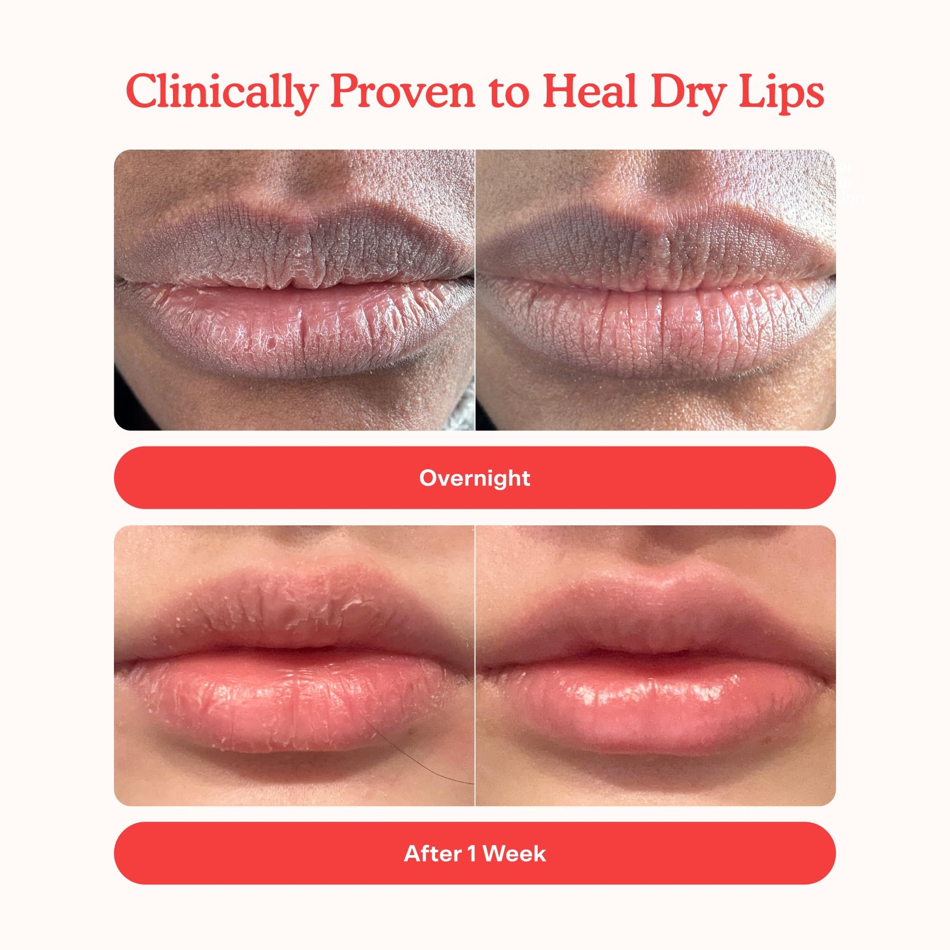 Tower 28 LipSoftie Tinted Lip Balm Treatment - Hydrating Glossy Balm + Overnight Lip Mask with Jojoba Oil + Shea Butter - Sweet, Cushiony Formula for Smooth, Soft Lips - Watermelon Kiwi (0.38 oz) Tower 28Buy Supplements Australia