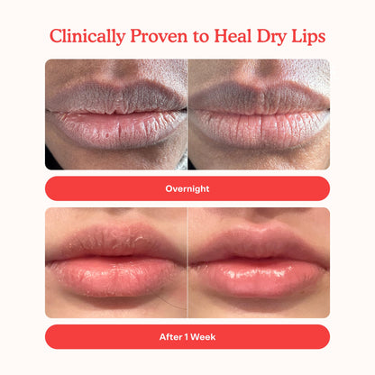 Tower 28 LipSoftie Tinted Lip Balm Treatment - Hydrating Glossy Balm + Overnight Lip Mask with Jojoba Oil + Shea Butter - Sweet, Cushiony Formula for Smooth, Soft Lips - Watermelon Kiwi (0.38 oz) Tower 28Buy Supplements Australia