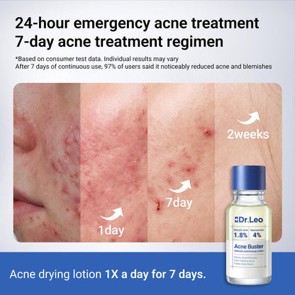 Dr.Leo 1.8% Salicylic Acid Spot Serum, Acne Treatment for Acne-Prone Sensitive Skin | Niacinamide, Fast Pimple Relief, Fades Acne Marks