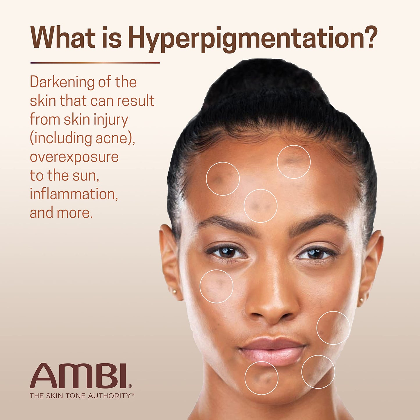 Ambi Even & Clear Advanced Fade Cream, Hydroquinone-free, Hyperpigmentation Treatment, Stubborn Dark Spot Corrector, Results In As Little As 2-3 Weeks