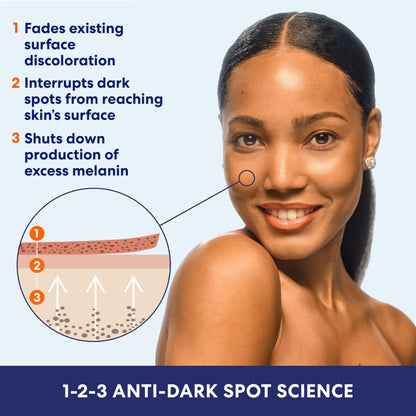 Palmer's Skin Success Anti-Dark Spot Fade Milk Body Lotion, 8.5 Ounce